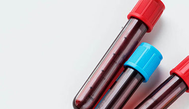 img_human_plasma_samples