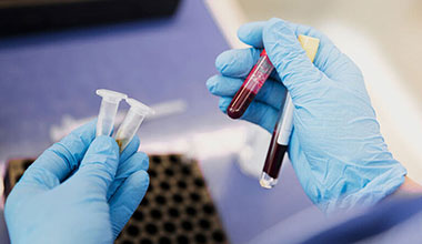 img_human_serum_samples