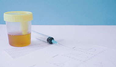 img_human_urine_samples