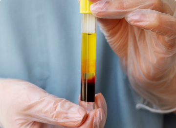 Human Plasma