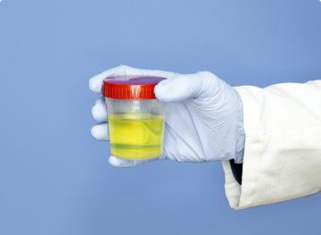 Human Urine