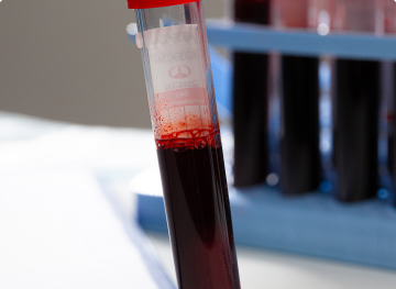 Whole Blood