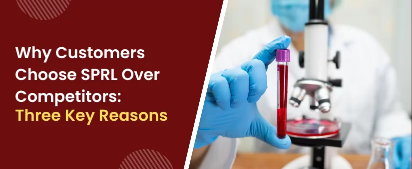 Why Customers Choose SPRL Over Competitors